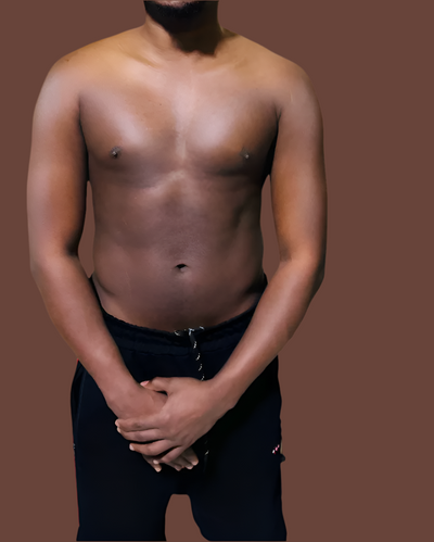 Before transformation