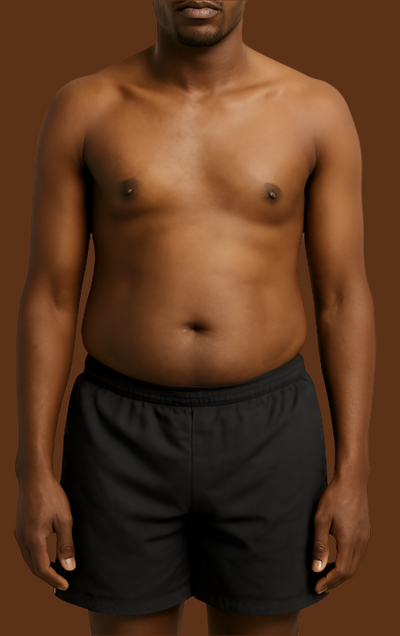 Before transformation